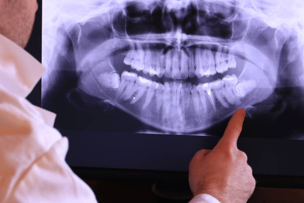 Best Emergency Treatment for Jaw Pain or Injury in Lakewood, IL